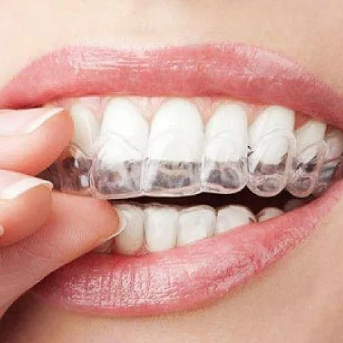 Smiling With Confidence: The Role Of Orthodontics In Boosting Self-Esteem